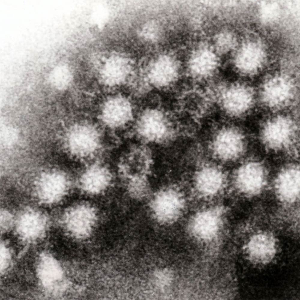 Norovirus